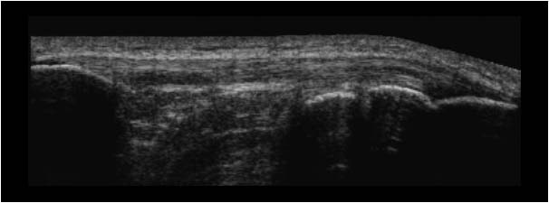 Right patellar tendon extended field of view
