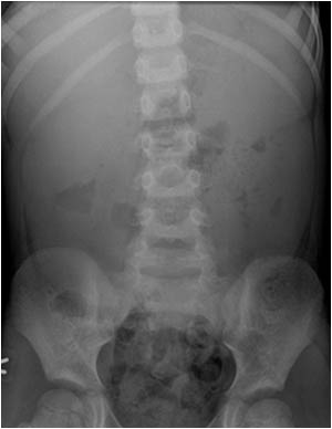 Case of the month February 2007: Miscellaneous urinary tract