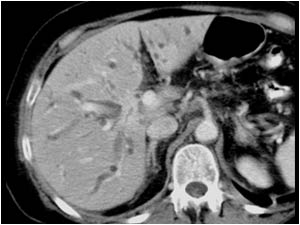Case of the month May 2007: Tumors
