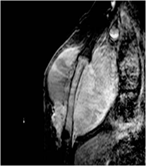Case of the month June 2008: Malignant tumors