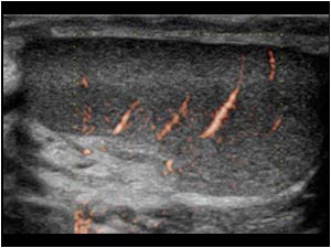 Longitudinal image with e-flow of the normal left testis