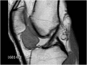 Miscellaneous medial knee