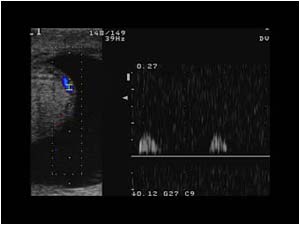 High resistance flow pattern in the epididymis