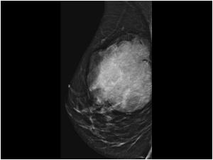 Mammography in 2012