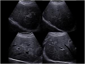 Here are four images of the same patient