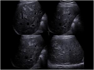 Another series of images of the liver