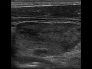 Longitudinal image of the contralateral side