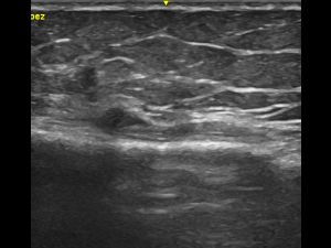 Long axis pictures of Sartorius