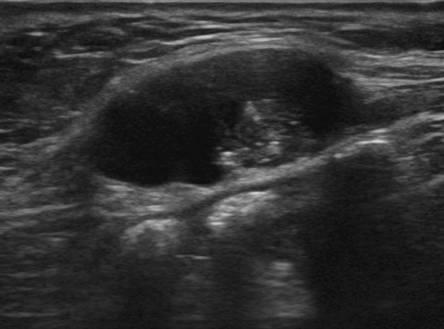 September 2013 | Ultrasound Cases